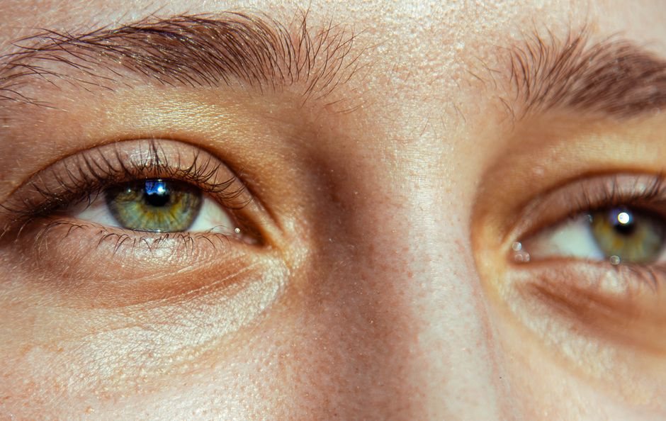 Lift Droopy Eyelids: The Face Yoga Method for Brighter Eyes