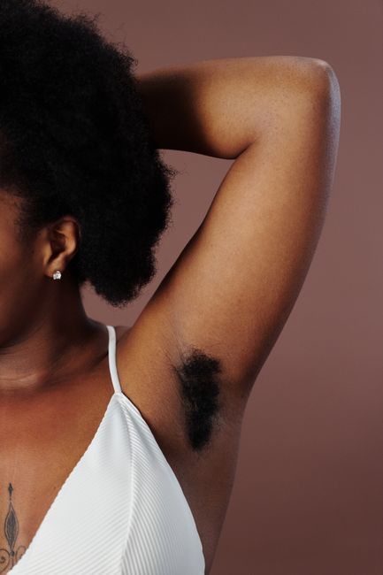 Beyond Deodorant: The Definitive Guide to Fixing Dark Armpits